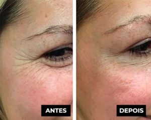 Placenta Glow Rejuvenescimento Celular