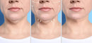 Máscara de Contorno Facial - Suaviza Rugas, Papada e Modela o Rosto