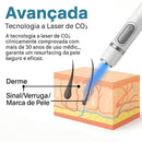 Caneta Laser MediSkin™ – Remove Manchas, Verrugas e Sinais Sem Dor