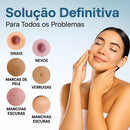Caneta Laser MediSkin™ – Remove Manchas, Verrugas e Sinais Sem Dor