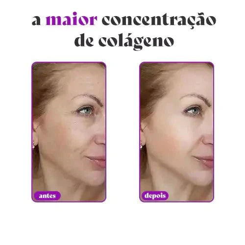 CollagenBoost - Máscara De Colágeno Que Revitalize e Renova a Pele