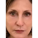 Retinol Rejuvenescedor