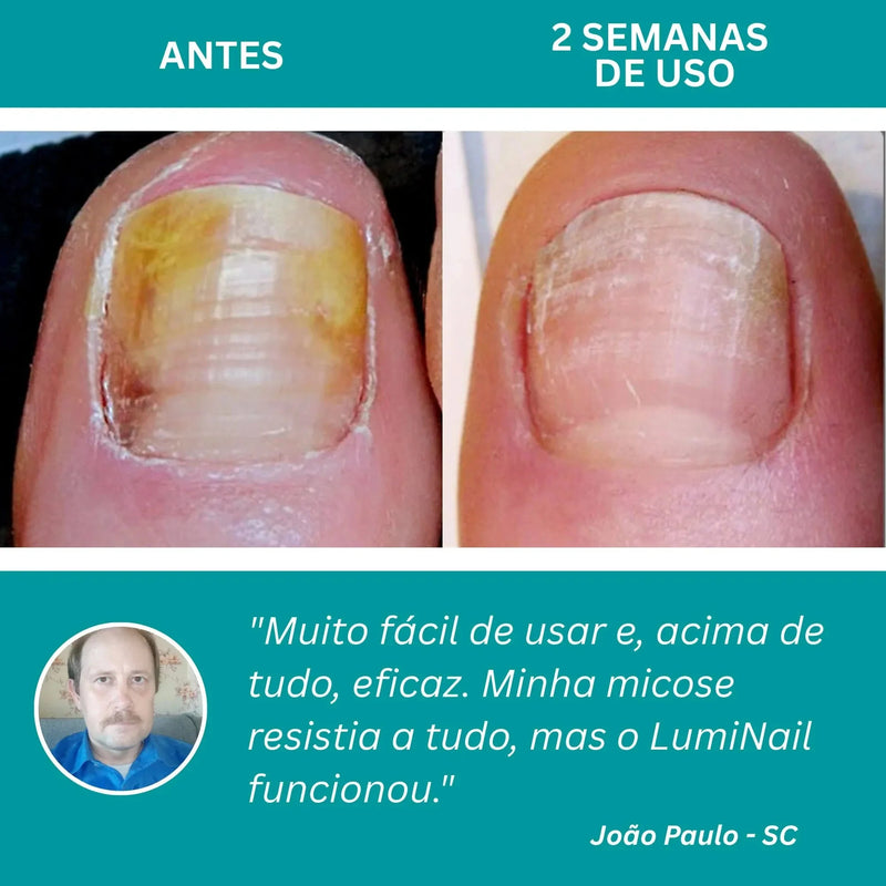 LumiNail Pro