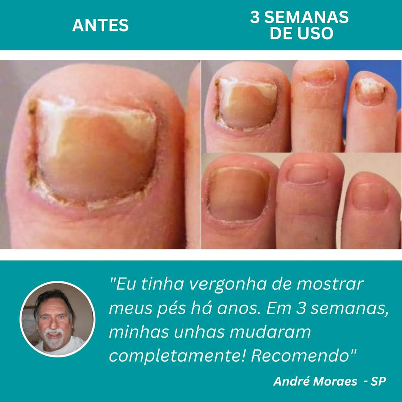 LumiNail Pro