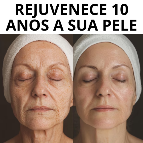 Remove Rugas 2 MINUTOS Instant FIRMx®