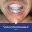 NeoVita® Protetor Bucal Ajustável Anti-Ronco