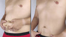 Adesivos de Moringa Emagrecedor 7 pacotes